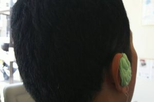 耳型採取